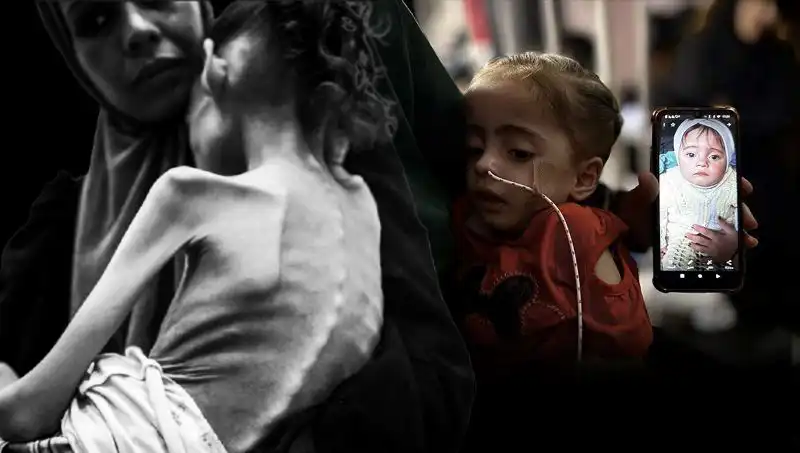 Küçük Meryem’in Dramı: 25 Kilodan 10 Kiloya Düşen Bir Hayat